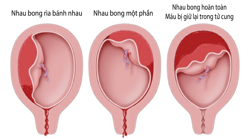 Xử trí tích cực giai đoạn 3 của cuộc chuyển dạ - Nhà thuốc FPT Long Châu